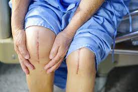 Orthopaedic Surgeon Doctors in Chennai